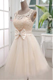 2024 A Line Scoop Tulle & Lace Homecoming Dresses P9G9TCEC